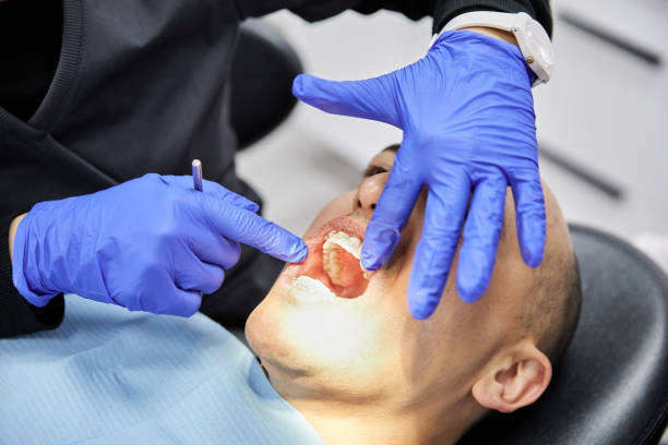 Best Emergency Wisdom Tooth Extraction in Rice, MN